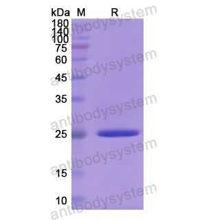 Recombinant Human DDX58, N-His