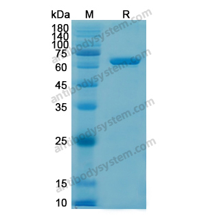 Recombinant Human AIFM1/AIF, N-His