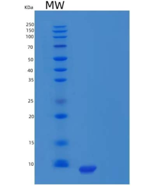 Recombinant Human Pancreatic Polypeptide/PPY Protein(C-6His)