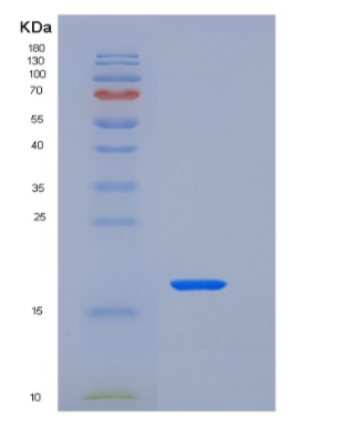 Recombinant Human Parathyroid Hormone-Related Protein/PTHLH Protein(C-6His)