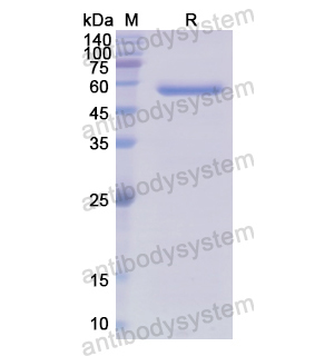 Recombinant Human ITGBL1, C-His