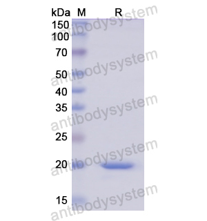 Recombinant Human AGR2/HPC8, N-His