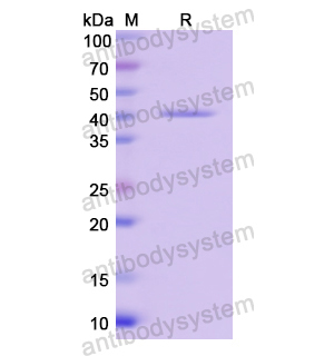 Recombinant Human TOMM40, N-His