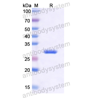 Recombinant Human PAK4, N-His