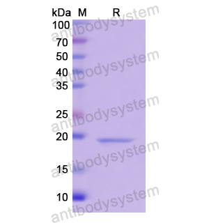 Recombinant Human WNT11, N-His