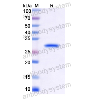 Recombinant Human CHEK2, N-His