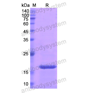 Recombinant Human SOD1, N-His