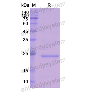 Recombinant Human AK1, N-His