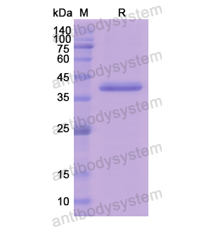 Recombinant Human C1R, N-His