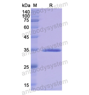 Recombinant Human PLG, N-His