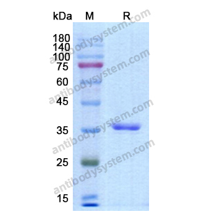 Recombinant Human F12, N-His