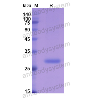 Recombinant Human CA1, N-His