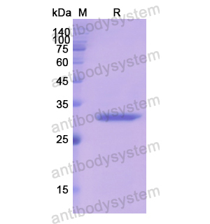 Recombinant Human CA2, N-His