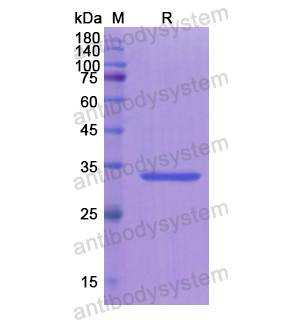 Recombinant Human ASS1, N-His