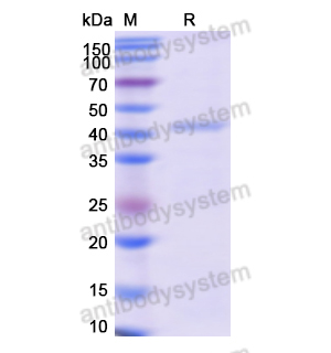 Recombinant Human SERPINA3, N-GST