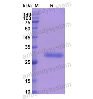 Recombinant Human A2M, N-His