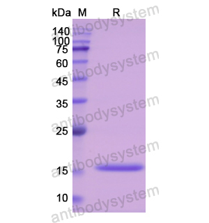 Recombinant Human CST3, C-His