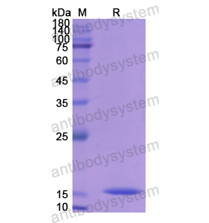 Recombinant Human CST4, N-His