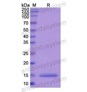 Recombinant Human KNG1, N-His