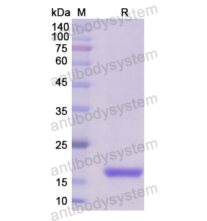 Recombinant Human KRAS, N-His