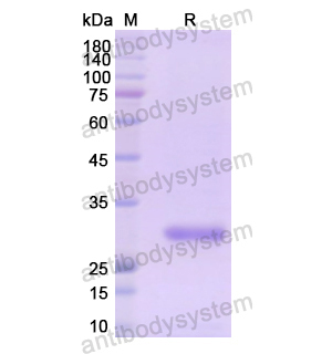 Recombinant Human LDLR, N-His