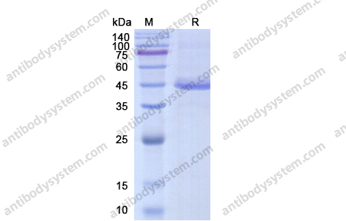 Recombinant Human TGFB1/TGF-beta-1, N-His