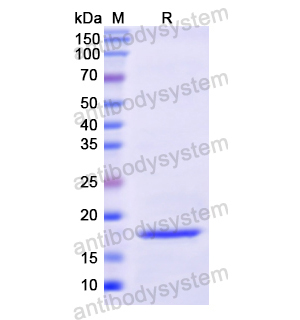 Recombinant Human AVP, N-His