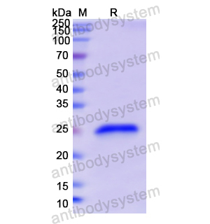 Recombinant Human GH1, N-His