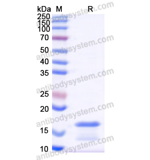 Recombinant Human PCT/Procalcitonin Protein, N-His