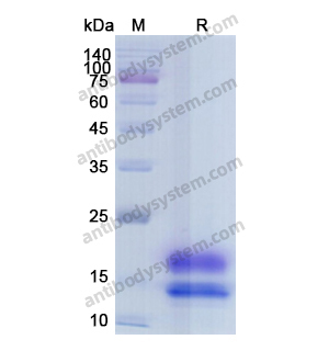 Recombinant Human PCT/Procalcitonin Protein, C-His