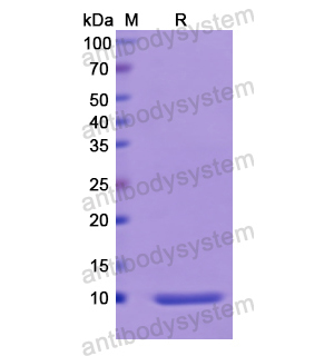 Recombinant Human PTH, N-His