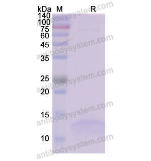 Recombinant Human PTH, C-His