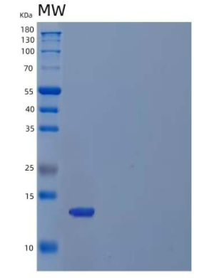 Recombinant Human C-X-C Motif Chemokine 9/CXCL9/MIG Protein(C-6His)