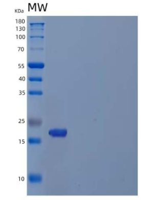 Recombinant Human Inosine Triphosphate Pyrophosphatase/ITPase Protein(C-6His)