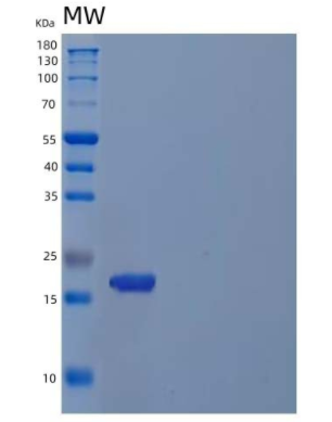 Recombinant Human Cyclin-Dependent Kinase 4 Inhibitor C/CDKN2C Protein(N-6His)