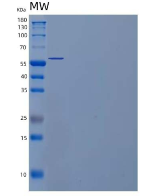 Recombinant Human Tryptophan 5-Hydroxylase 2/TPH2 Protein(N-6His)