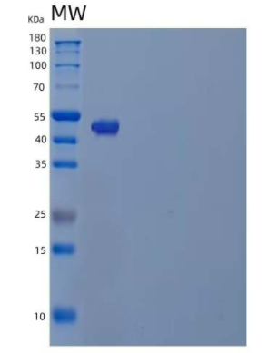 Recombinant Human Tubulin β-4A Chain/TUBB4A Protein(N-6His)