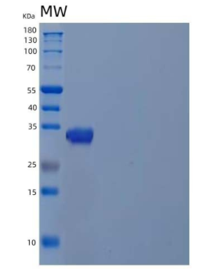 Recombinant Human Cyclophilin C/PPIase C/PPIC Protein(N-Trx, 6His)