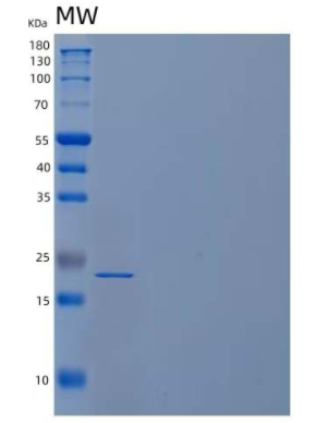 Recombinant Human Tumor Necrosis Factor α/TNFα Protein(N-6His)