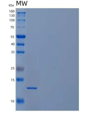 Recombinant Human Cystatin C/CST3 Protein.