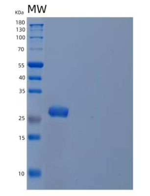 Recombinant Human Peroxiredoxin-6/PRDX6 Protein(N-6His)