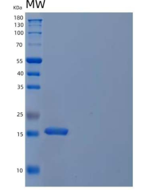 Recombinant Human Cystatin S/CST4 Protein(C-6His)