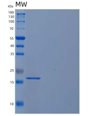 Recombinant Human U6 snRNA-Associated Sm-Like Protein LSm1/LSM1 Protein(C-6His)