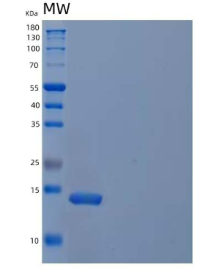 Recombinant Mouse Interleukin-21/IL-21 Protein(N-6His)
