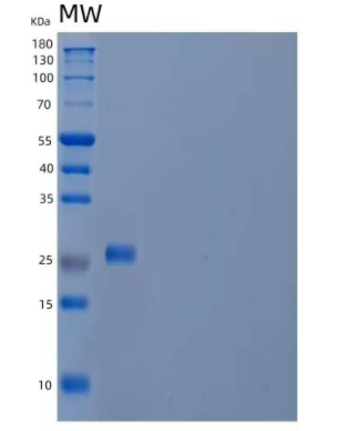 Recombinant Human Acrosomal Protein SP-10/ACRV1 Protein(C-6His)