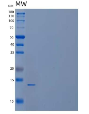 Recombinant Human Cytochrome b5 B/CYB5B Protein(C-6His)