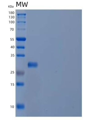 Recombinant Human Phosphomannomutase 2/PMM2 Protein(C-6His)