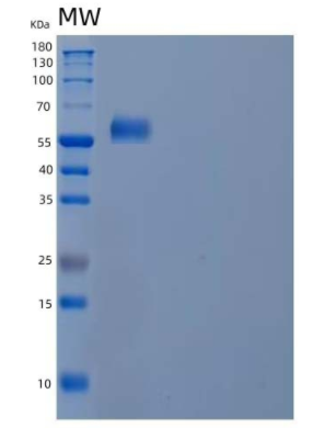 Recombinant Human Ubiquitin-Associated Protein 1/UBAP1/NAG20 Protein(C-6His)