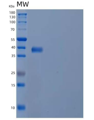 Recombinant Human Cytochrome b-c1 Complex Subunit 6/UQCRH Protein(N-GST)