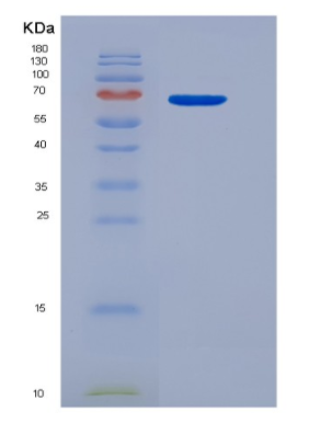 Eukaryotic Interleukin 13 (IL13)